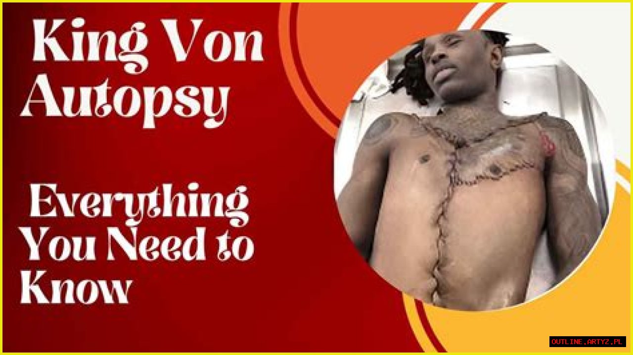King Von Autopsy Photo: An Insight Into The Life And Legacy Of A Rising Star